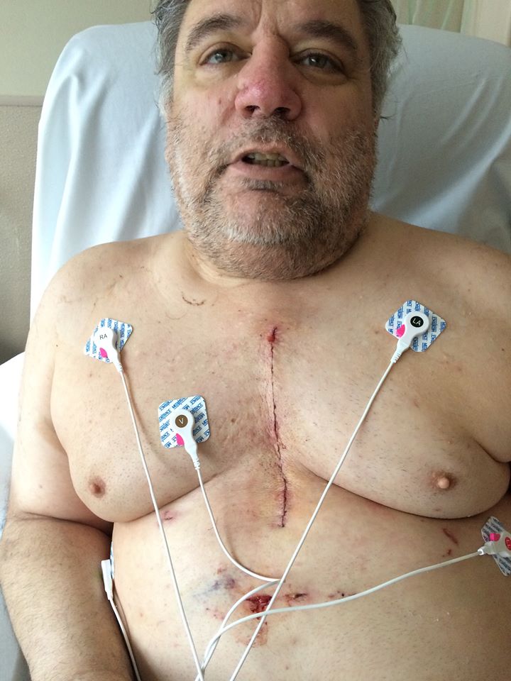 Henry Frederick after surgery for an aorta amerysm / Headline Surfer
