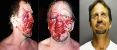 Henry Wheeler, badluy beaten in Traders Bar in New Smyrna Beach in 2011 / Headline Surfer
